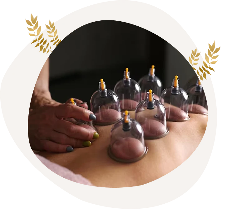 Benefits of Wodonga Cupping Massage