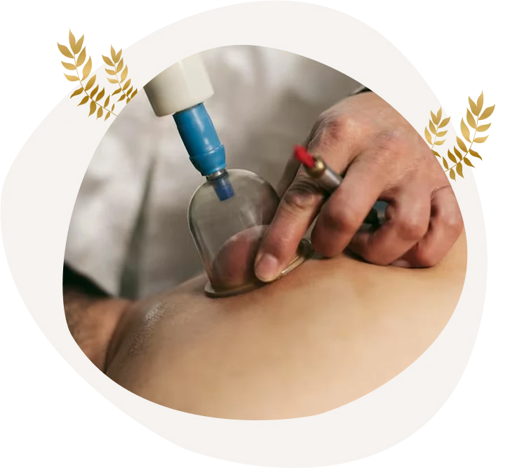 Benefits of Cupping Massage in Finley
